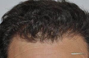 larger-grimaldi-after