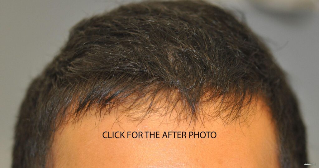 Hair Loss Doctor NYC